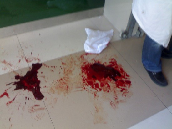 杭州一储蓄所发生血案