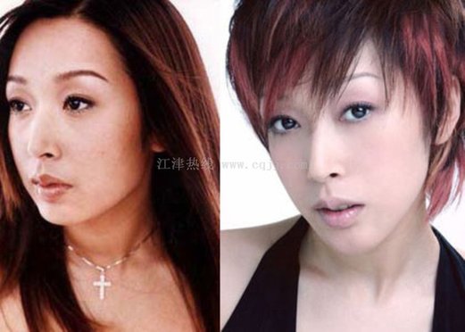 金喜善女儿被批太丑 明星整容前后对比