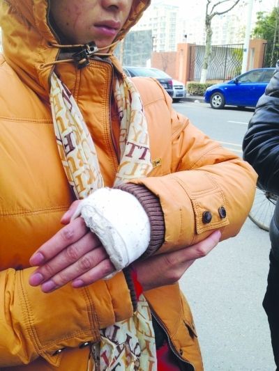 卢女士左手骨折.曹卢杰 摄