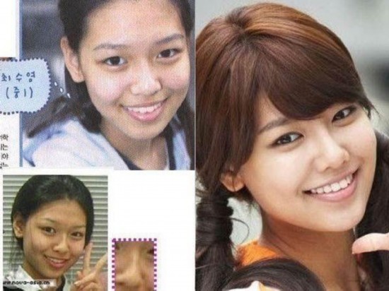 <em>少女时代</em>秀英