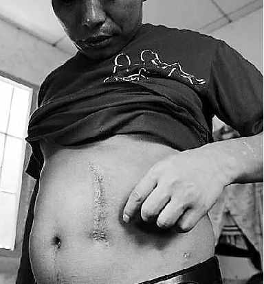 浙江非法买卖人体器官案:9名被告6人卖掉自己