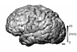 你的舌头打结吗?灰化肥为啥这么难