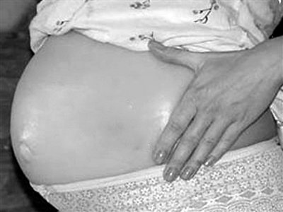 北京女子戴硅胶肚皮装孕妇地铁骗座 露馅后投