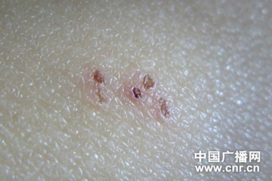 河北燕郊一幼儿园<em>教师</em>涉嫌针扎虐待儿童 教委