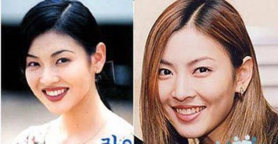 图揭韩国女星整容后遗症