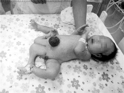 ���գ���һ��ͯҽԺ��ͯ�໤�ң����ȱ�������Ӥ�������ϡ���ʹ�������ͼ