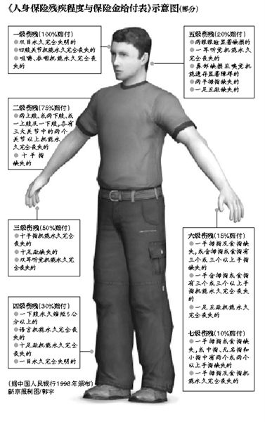 新京报讯 （记者刘洋）因保险公司使用的相关理赔条例14年未曾修订过，近日，朝阳法院向中国保监会发出司法建议，建议大幅修订《人身保险残疾程度与保险金给付比例表》（简称《比例表》）。