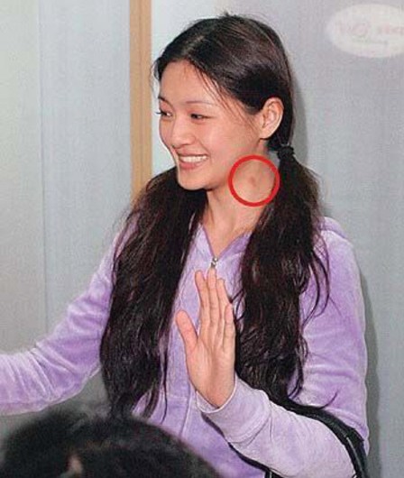 董卿李冰冰徐若瑄 女星脖颈胸口吻痕遭拍[图]