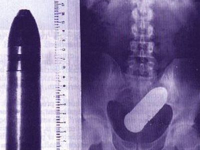 组图:<em>女人</em>的<em>私处</em>竟然能放下这些东西【7】--人