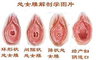 每个未婚女子<em>的生殖器官</em>上