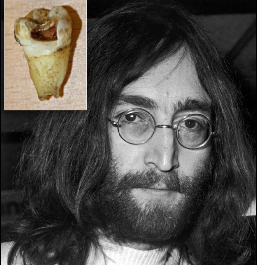 翰 列侬有望复活?加拿大牙医望用其牙齿DNA克隆