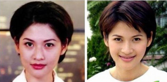 沈星被捉奸图揭沈星整容前后对比照组图3