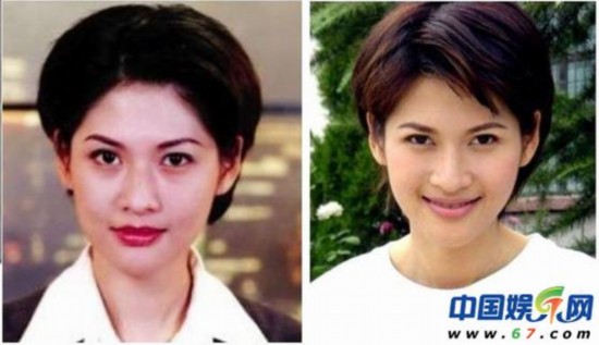 沈星被曝整容
