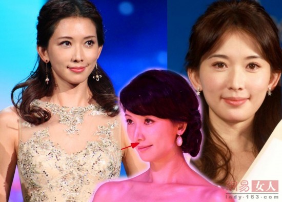 郭晶晶"蛤蟆嘴"林志玲"大鼻孔" 揭女星身上的"缺陷"部位【3】