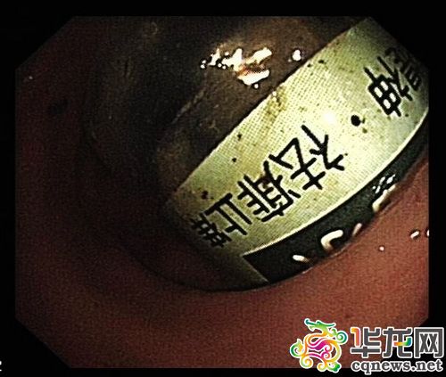 美女开肠子_养生女人20岁后最易衰老的十个器官组图