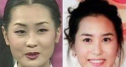中国<em>丑女</em>韩整容节目<em>变美女</em> 变女神整容秘籍【