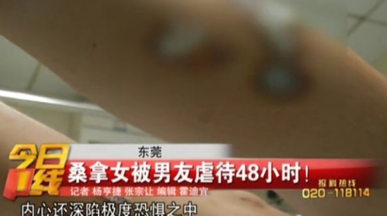 桑拿女被男友虐待48小时+扒旅馆厕所窗户得以
