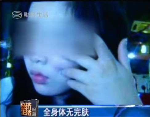 桑拿女被男友<em>虐待</em>48小时 变态性虐烟头烫乳房