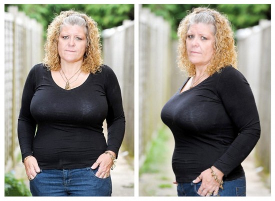 英母亲因巨乳影响生活欲手术(组图)【2】--人