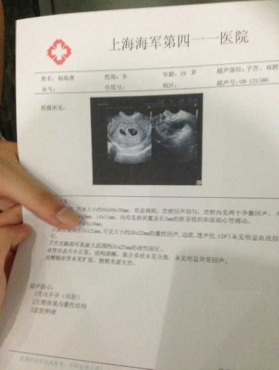 少女人流手术前晒双胞胎b超图 引发热议