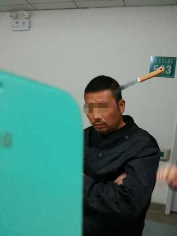 延吉男子头插水果刀就医 被网友封淡定哥(图