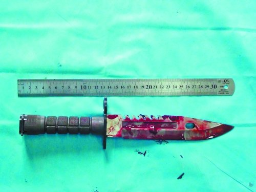 �ɷ������������� ������35���׼⵶����Ů��