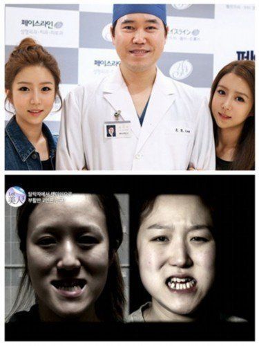 韩国双胞胎整容逆袭+丑女大翻身美呆了惊艳网友