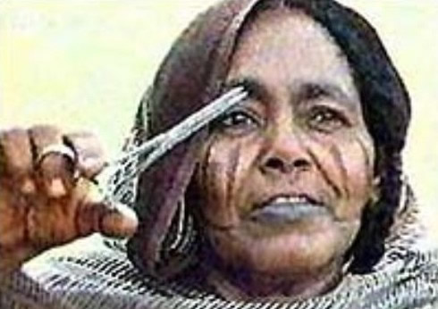 惨无人道!现场实拍印尼女孩神秘割阴手术(图)