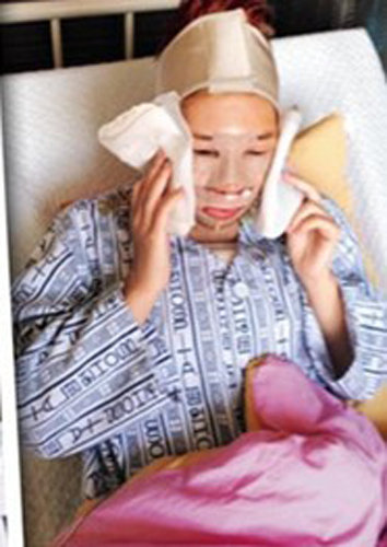 港三级艳星韩国整容过程曝光 惊悚变猪头妹