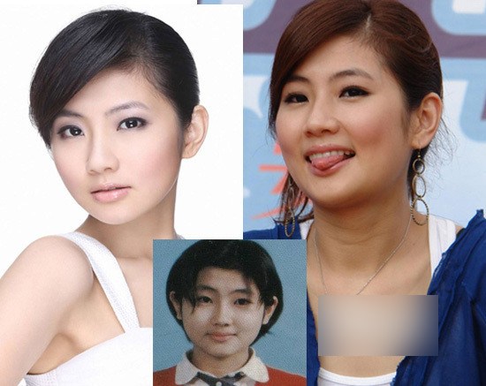 selina,现在很漂亮,皮肤超级棒,希望她早日康复,恢复往日靓丽.