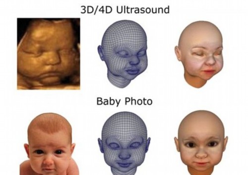 3D打印带你见未出生胎儿 体位表情皮肤皆可见