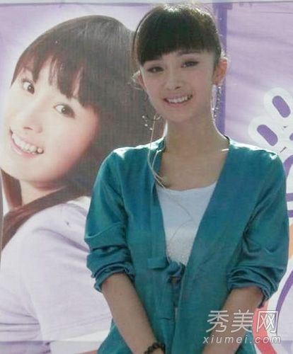 杨幂下颚&Baby鼻子 女明星整容前后太离谱