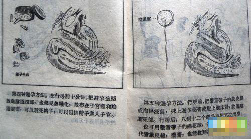 组图:52年前夫妻这样避孕 安全套要擦石灰粉润