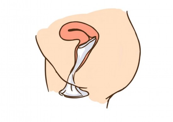 详细图解女式避孕套使用方法(组图)【7】--陕西