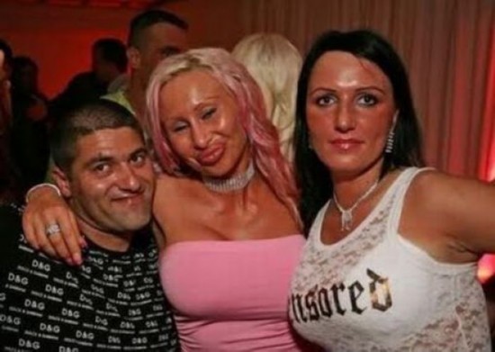 重口味时间:世界整容手术失败40例