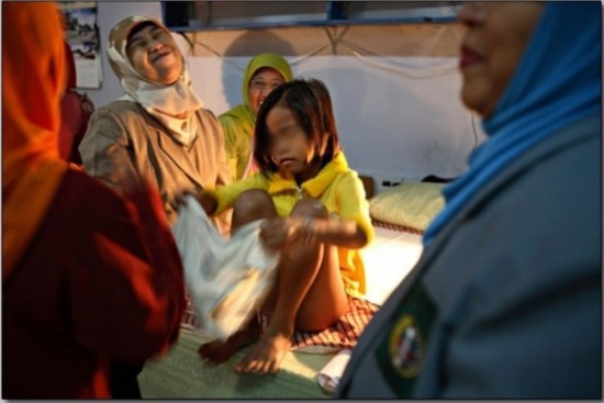 实拍印尼女孩割礼手术:割除一部分性器官