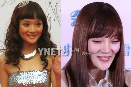 女星整容失败案例:郑爽李小璐变残+赵丽颖唐嫣