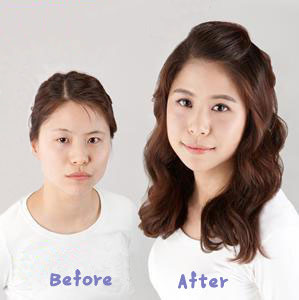 看我开眼角前后对比图 小眼瞬间变大