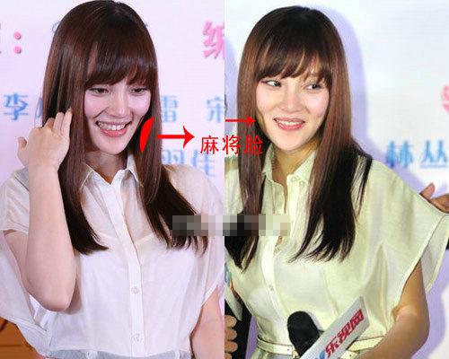 赵丽颖袁姗姗杨颖郑爽85后花旦整容前后变化