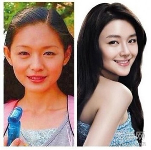 大S王菲张曼玉注射丰苹果肌 女星童颜永驻有可