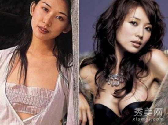 姚笛杨幂削骨 林志玲隆胸 