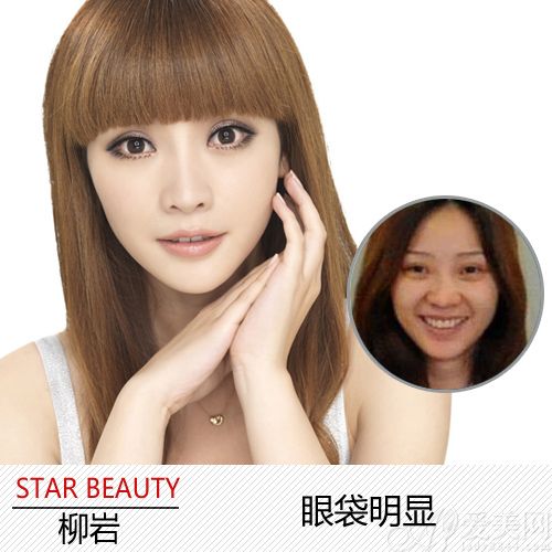 柳岩晒素颜照 浓妆女星卸妆后谁美谁残?