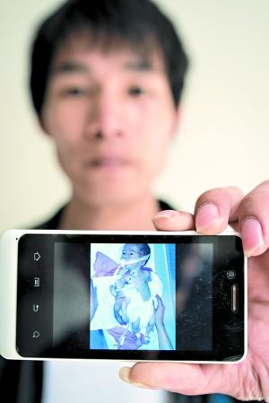 北京一小鸡产下双脚双手女生肚脐上男婴鸡广州女子图片图片