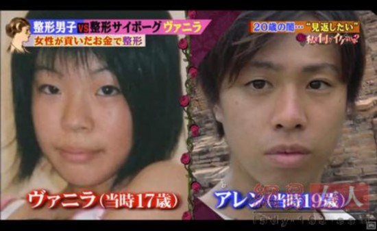 日本男整形成法国娃娃女 所有费用竟全靠女友