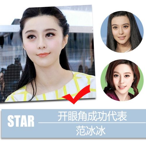 明星成整容"铁杆粉?盘点"星级"整容项目