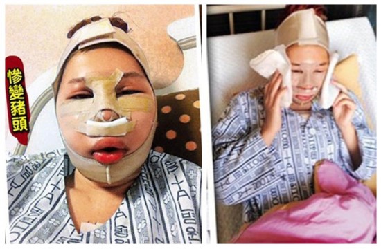 女星整容失败惨状巩新亮angelababy躺枪