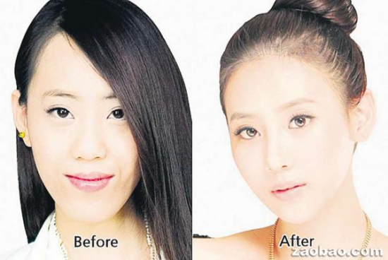 游客赴韩整容后海关认不出韩国医院忙着开证明