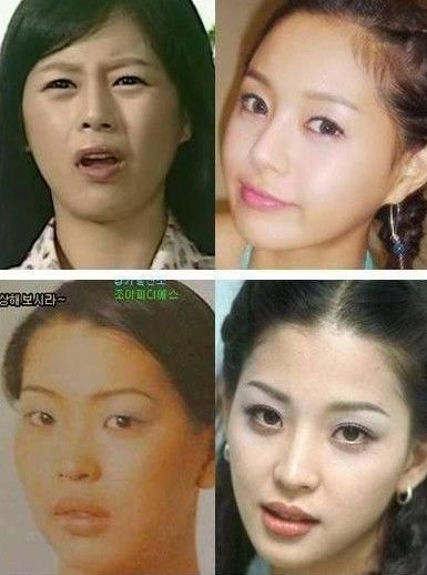 韩国男明星整容前后_韩国明星整容前后
