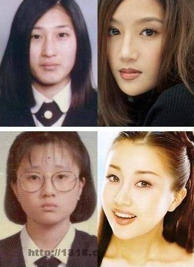 韩国男明星整容前后_韩国明星整容前后