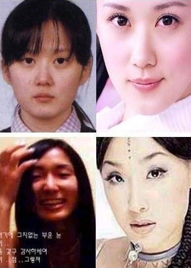 韩国男明星整容前后_韩国明星整容前后